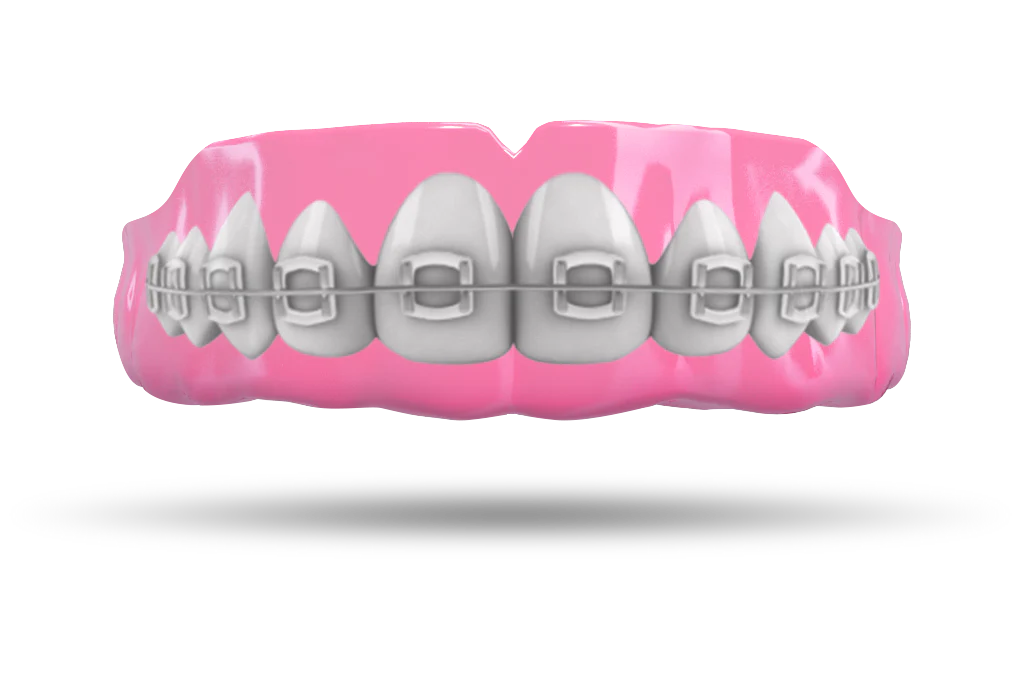 Pink Braces