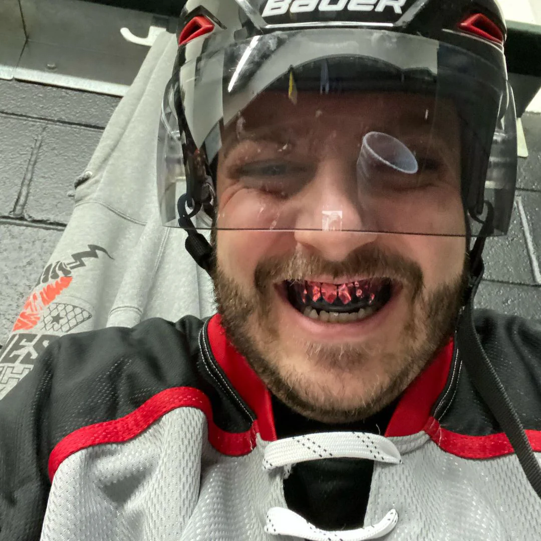 Chrome Red Fangs (Black) - Image 2